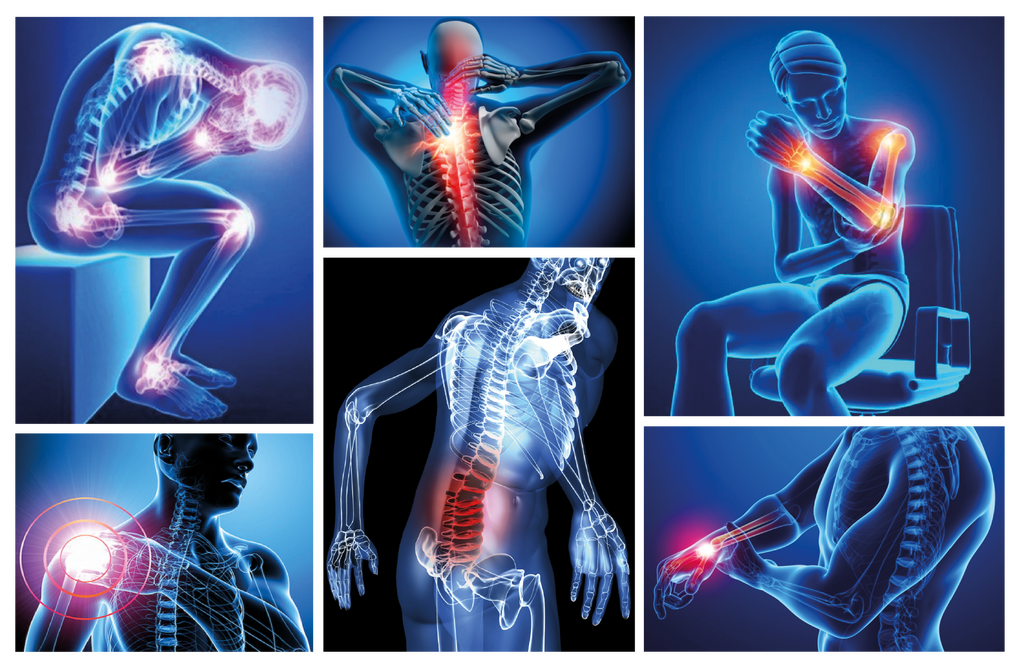 Lesiones musculo esqueléticas