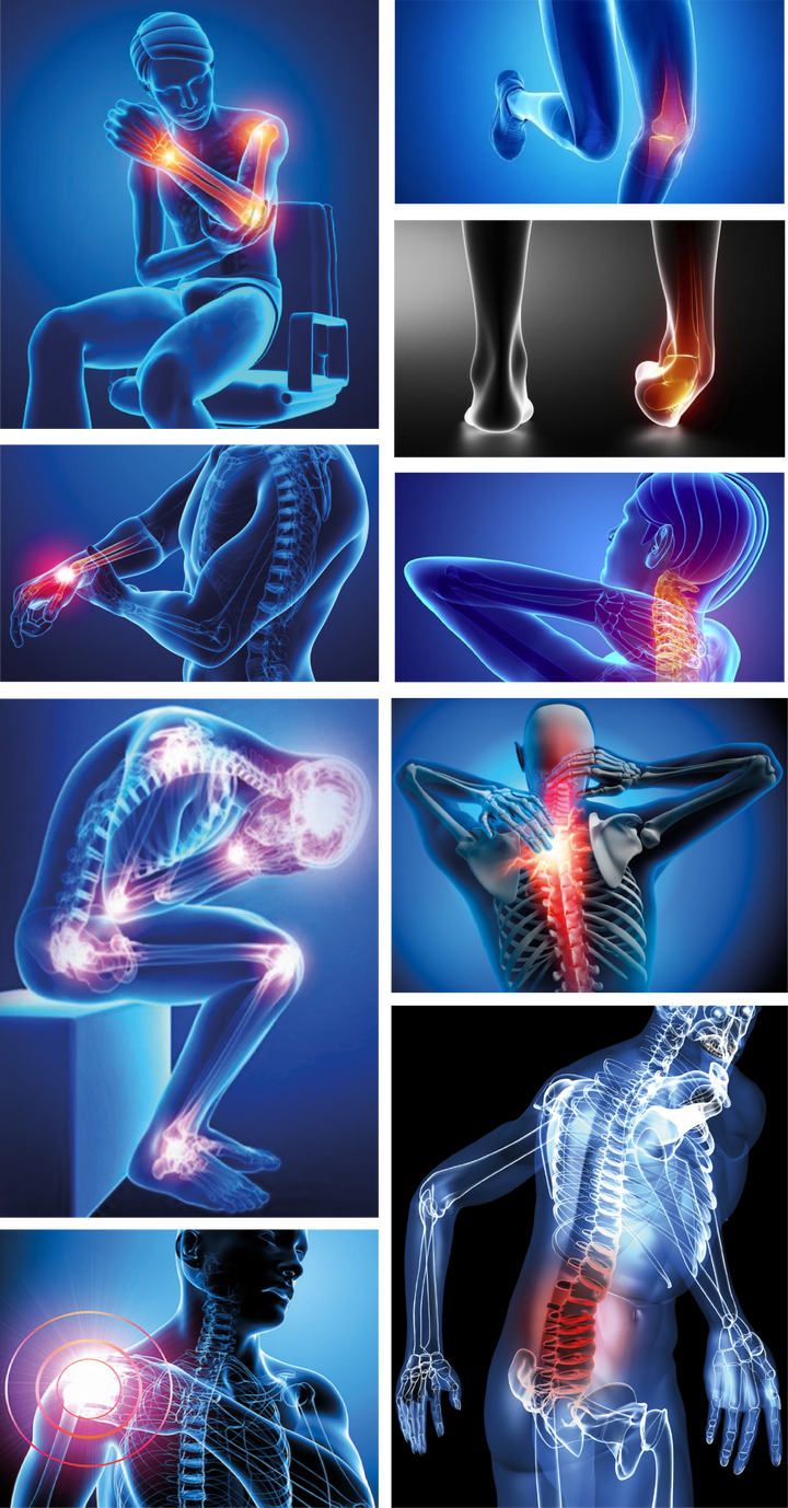 Lesiones musculo esqueléticas